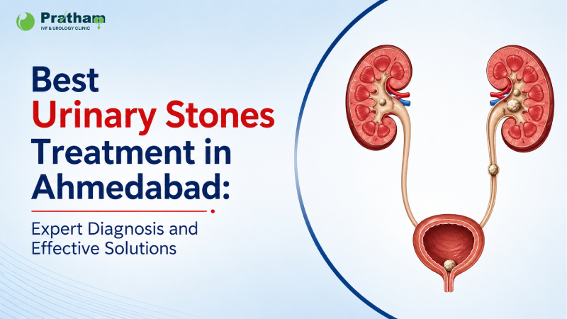 Best Urinary Stones Treatment in Ahmedabad: Expert Diagnosis and Effective Solutions