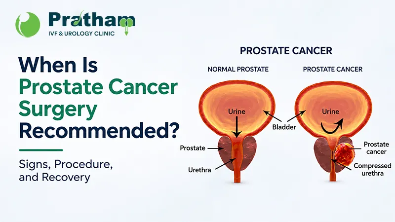 When Is Prostate Cancer Surgery Recommended? Signs, Procedure, and Recovery